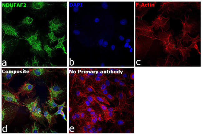 NDUFAF2 Antibody in Immunocytochemistry (ICC/IF)
