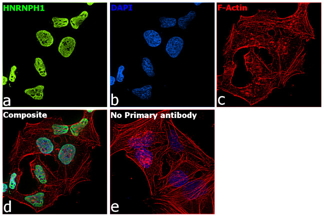 hnRNP H1 Antibody in Immunocytochemistry (ICC/IF)
