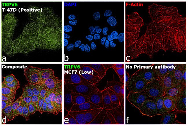 TRPV6 Antibody in Immunocytochemistry (ICC/IF)