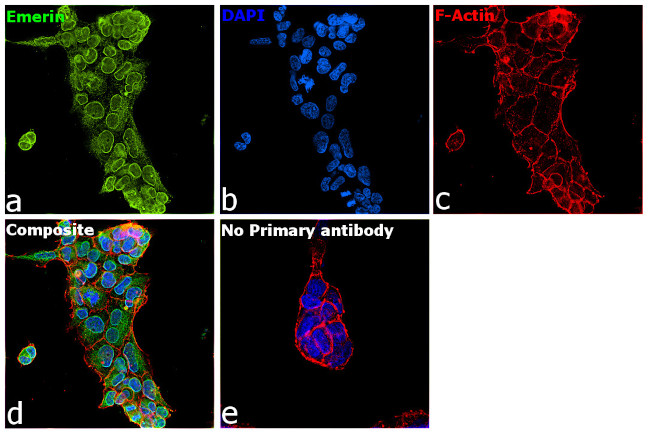 Emerin Antibody in Immunocytochemistry (ICC/IF)