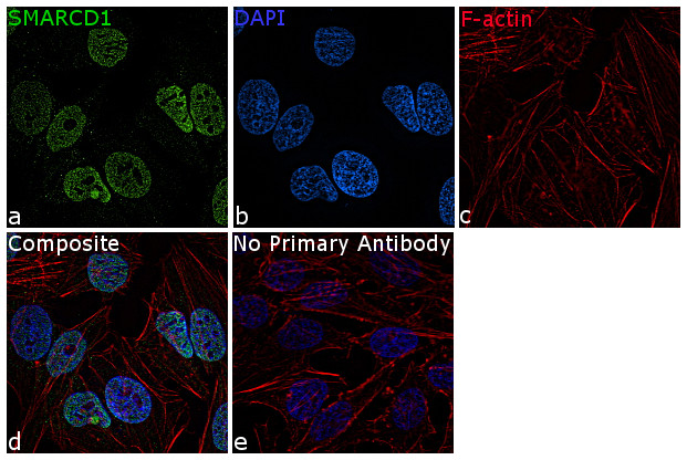 SMARCD1 Antibody in Immunocytochemistry (ICC/IF)