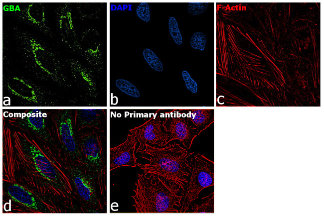 GBA Antibody in Immunocytochemistry (ICC/IF)