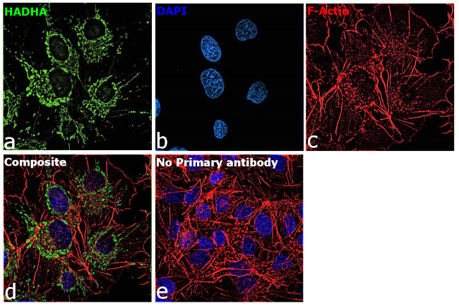 HADHA Antibody in Immunocytochemistry (ICC/IF)