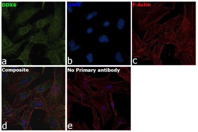DDX6 Antibody in Immunocytochemistry (ICC/IF)