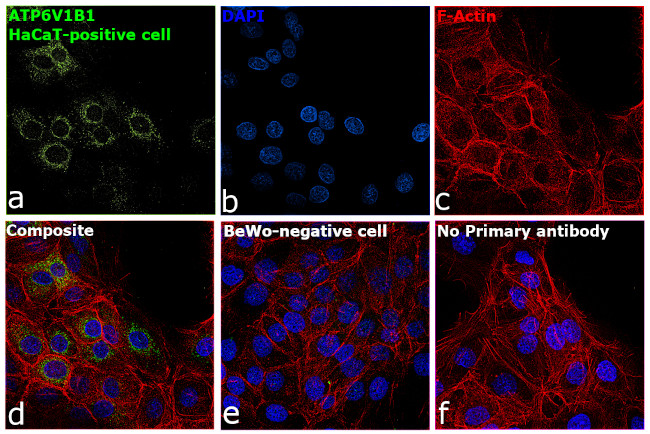 ATP6V1B1 Antibody in Immunocytochemistry (ICC/IF)