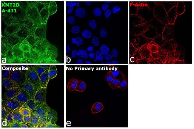 KMT2D Antibody in Immunocytochemistry (ICC/IF)