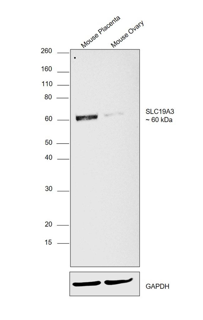 SLC19A3 Antibody in Western Blot (WB)