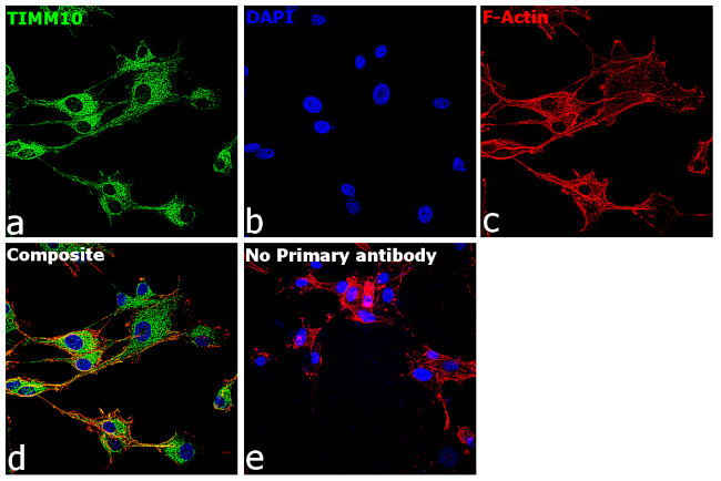 TIMM10 Antibody in Immunocytochemistry (ICC/IF)