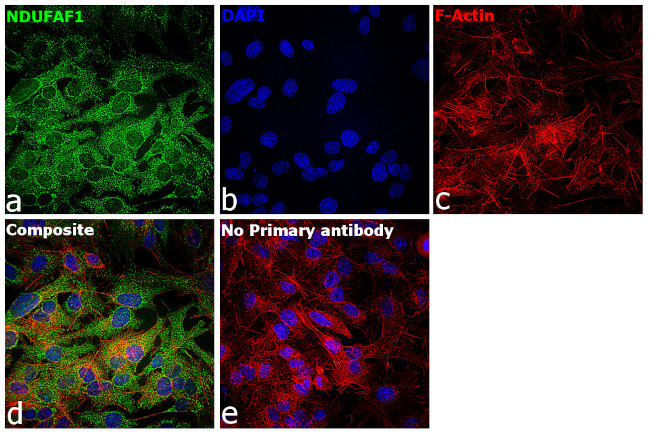 NDUFAF1 Antibody in Immunocytochemistry (ICC/IF)