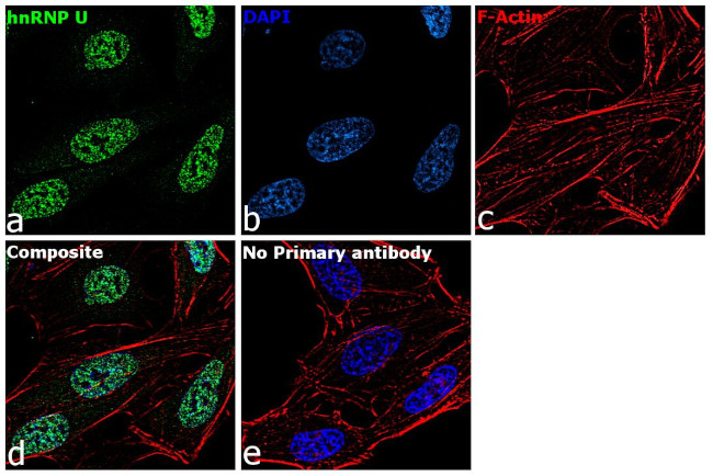 hnRNP U Antibody in Immunocytochemistry (ICC/IF)