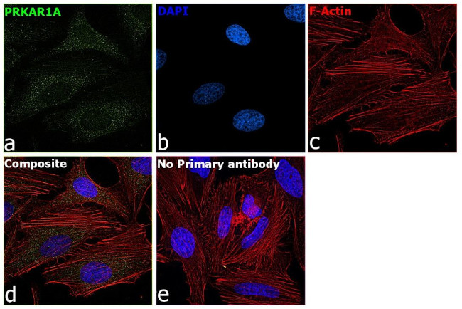 PRKAR1A Antibody in Immunocytochemistry (ICC/IF)