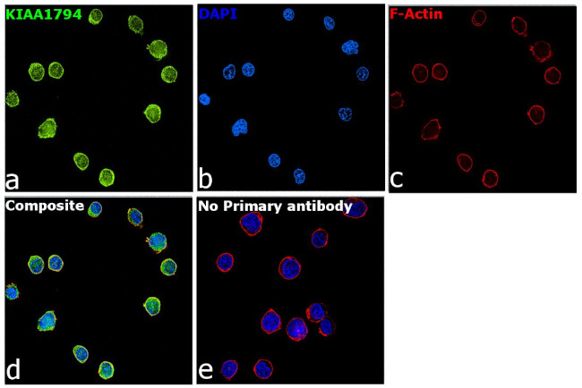 FANCI Antibody in Immunocytochemistry (ICC/IF)