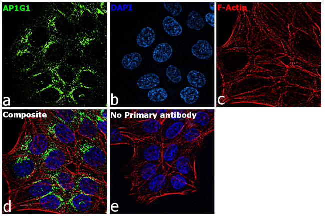 gamma Adaptin Antibody in Immunocytochemistry (ICC/IF)