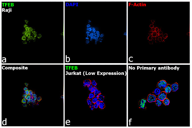 TFEB Antibody in Immunocytochemistry (ICC/IF)