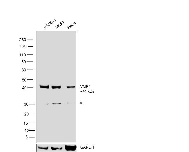 VMP1 Antibody in Western Blot (WB)