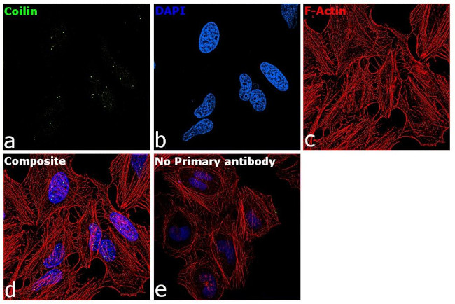 Coilin Antibody in Immunocytochemistry (ICC/IF)
