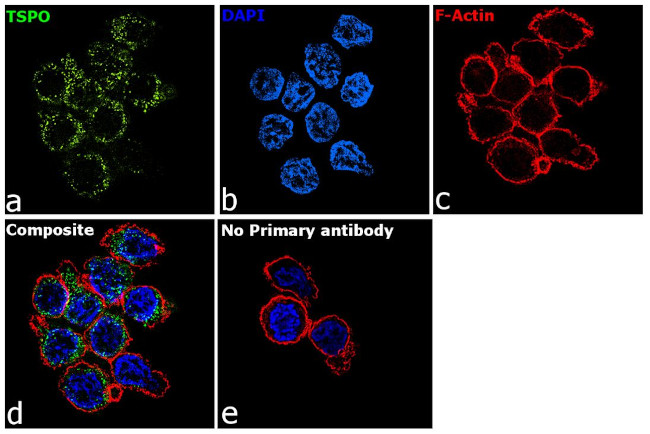 TSPO Antibody in Immunocytochemistry (ICC/IF)