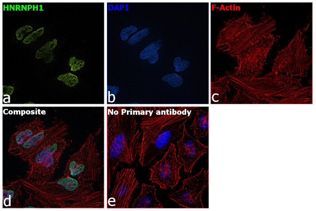 hnRNP H1 Antibody in Immunocytochemistry (ICC/IF)