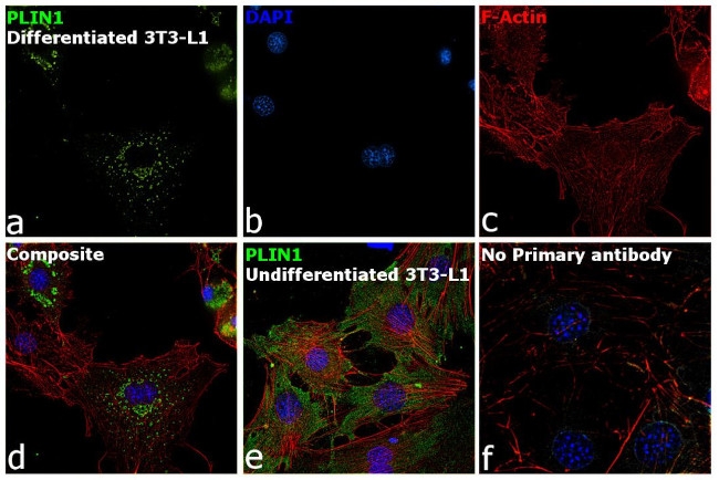 Perilipin 1 Antibody in Immunocytochemistry (ICC/IF)
