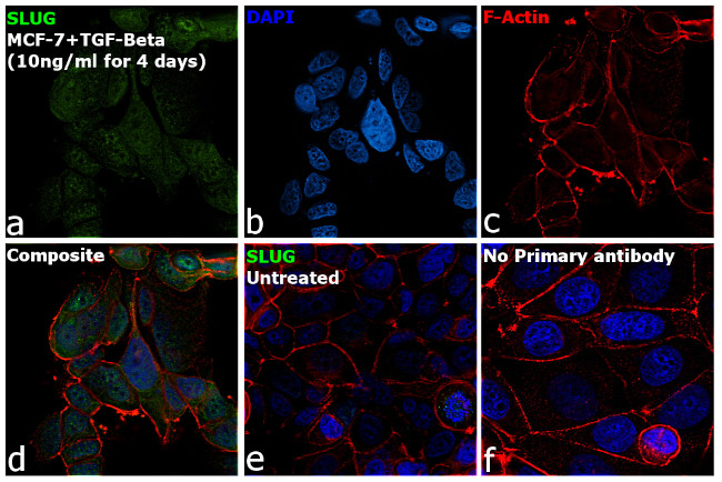 SLUG Antibody in Immunocytochemistry (ICC/IF)