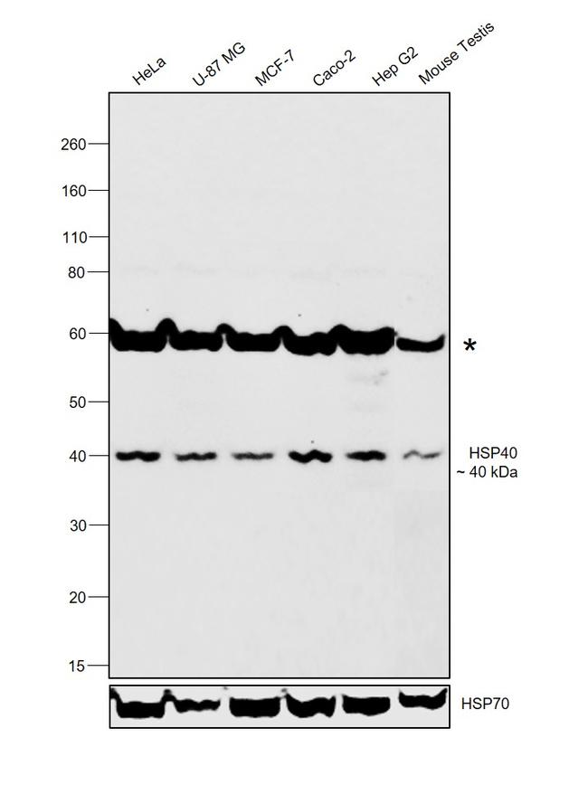 HSP40 Antibody in Western Blot (WB)