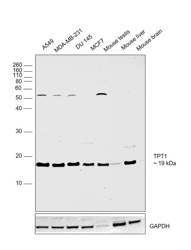 TPT1 Antibody in Western Blot (WB)