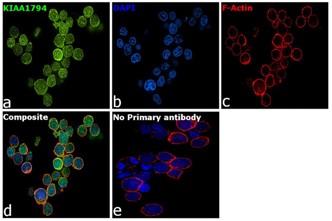 FANCI Antibody in Immunocytochemistry (ICC/IF)