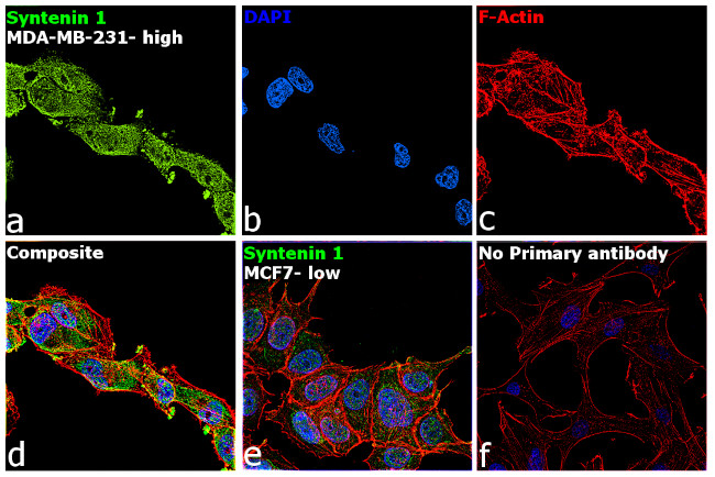 Syntenin 1 Antibody in Immunocytochemistry (ICC/IF)