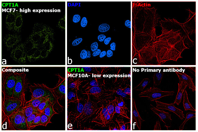 CPT1A Antibody in Immunocytochemistry (ICC/IF)
