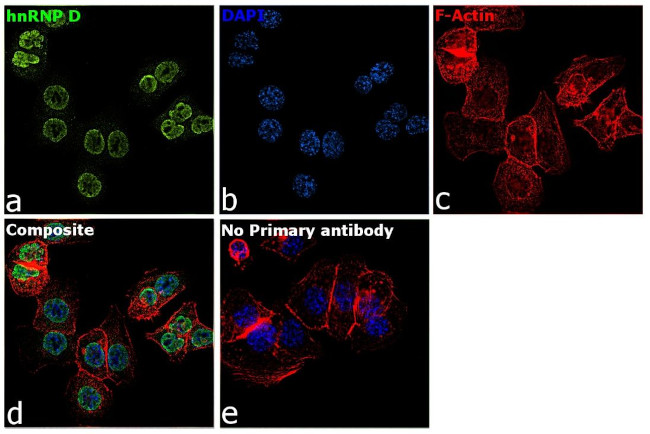 hnRNP D Antibody in Immunocytochemistry (ICC/IF)