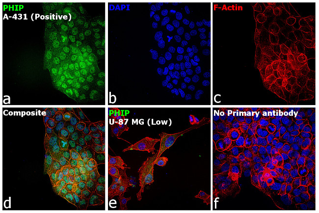 PHIP Antibody in Immunocytochemistry (ICC/IF)