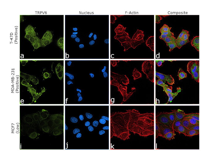 TRPV6 Antibody in Immunocytochemistry (ICC/IF)