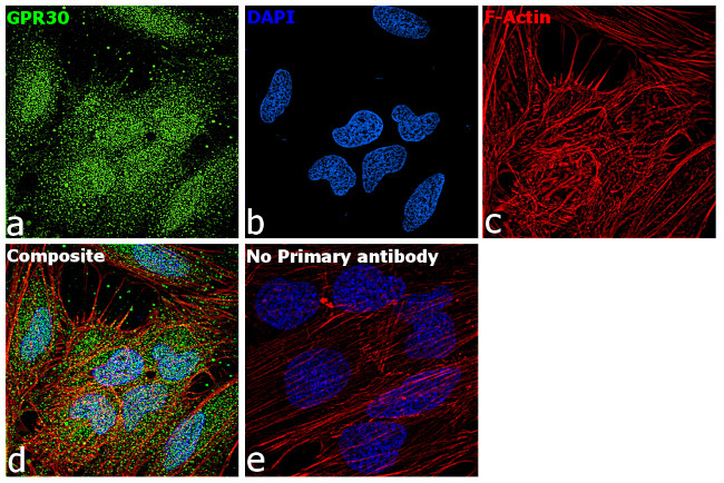 GPR30 Antibody in Immunocytochemistry (ICC/IF)