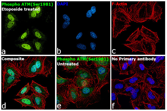 Phospho-ATM (Ser1981) Antibody in Immunocytochemistry (ICC/IF)