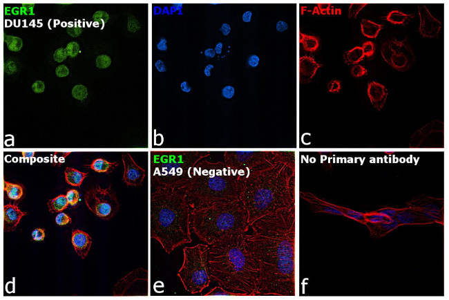 EGR1 Antibody in Immunocytochemistry (ICC/IF)