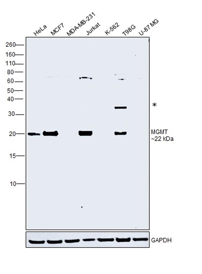 MGMT Antibody in Western Blot (WB)