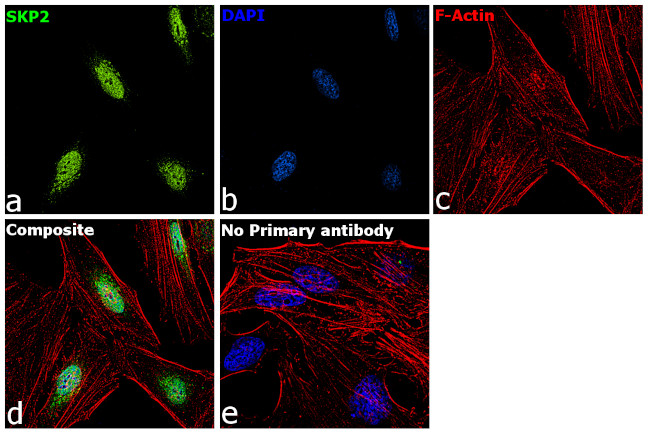 SKP2 Antibody in Immunocytochemistry (ICC/IF)