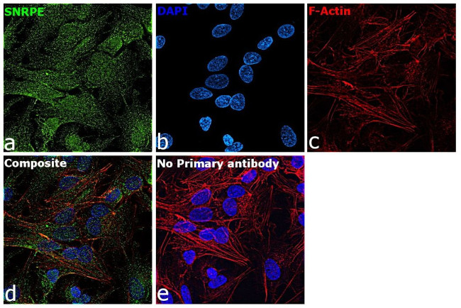 SNRPE Antibody in Immunocytochemistry (ICC/IF)