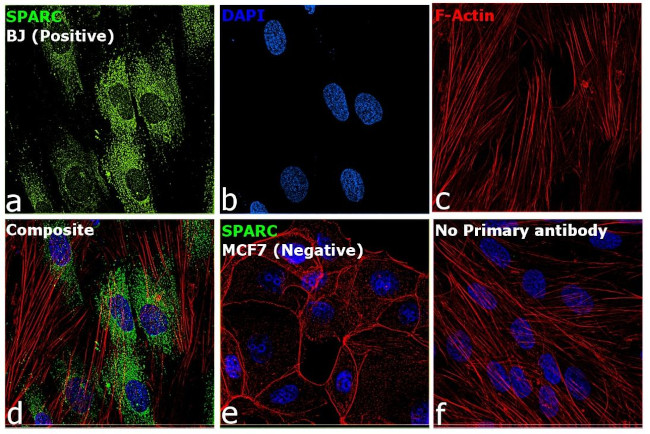 SPARC Antibody in Immunocytochemistry (ICC/IF)