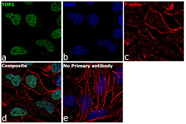 TOP1 Antibody in Immunocytochemistry (ICC/IF)