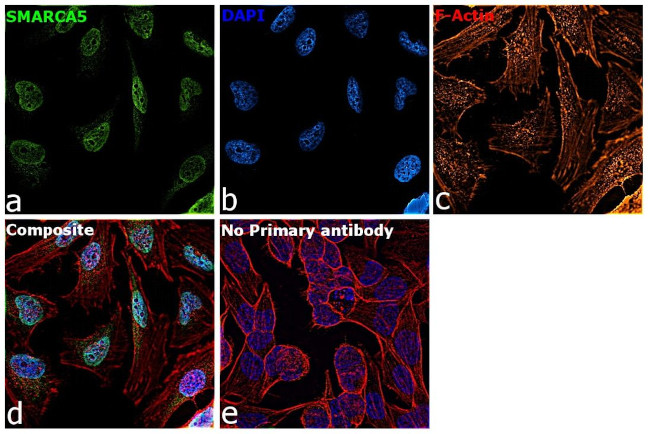 SMARCA5 Antibody in Immunocytochemistry (ICC/IF)