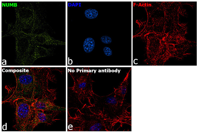 NUMB Antibody in Immunocytochemistry (ICC/IF)