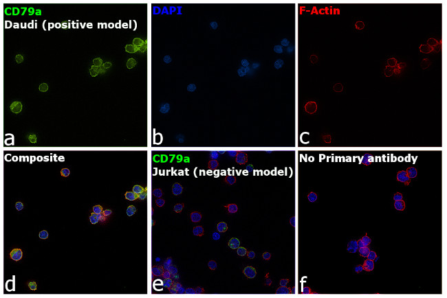 CD79a Antibody in Immunocytochemistry (ICC/IF)