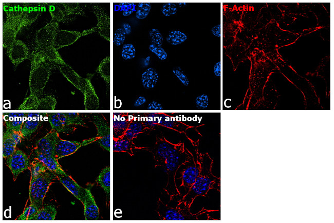 Cathepsin D Antibody in Immunocytochemistry (ICC/IF)