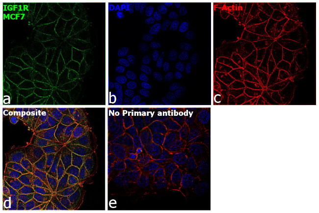IGF1R (CD221) Antibody in Immunocytochemistry (ICC/IF)