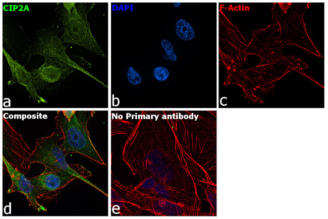 CIP2A Antibody in Immunocytochemistry (ICC/IF)