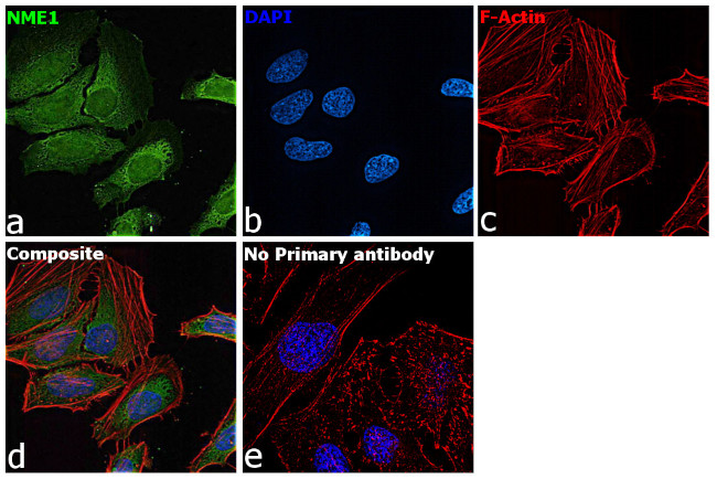 NME1 Antibody in Immunocytochemistry (ICC/IF)
