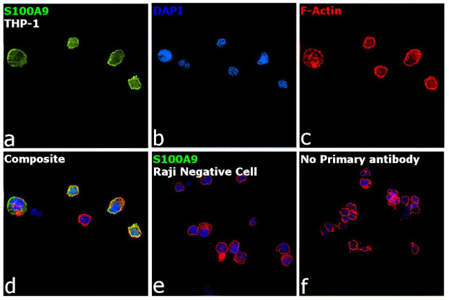 S100A9 Antibody in Immunocytochemistry (ICC/IF)
