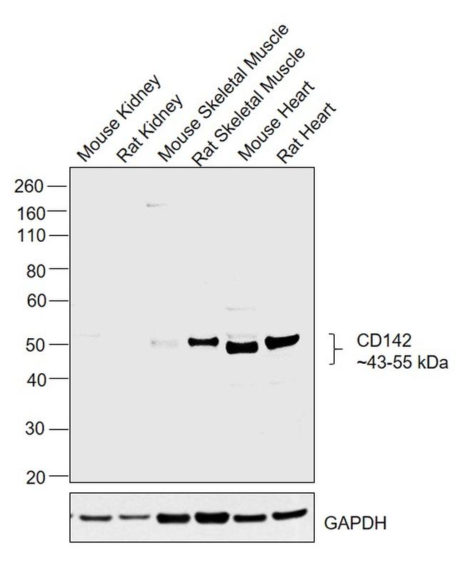 Alpha Sarcoglycan Antibody in Western Blot (WB)