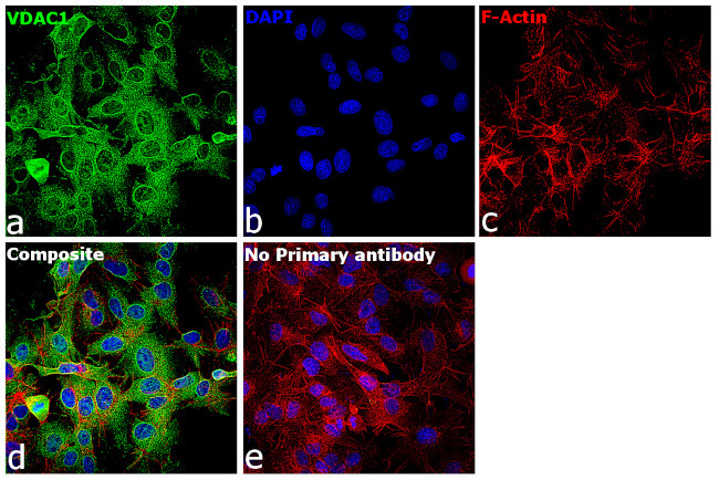 VDAC Antibody in Immunocytochemistry (ICC/IF)